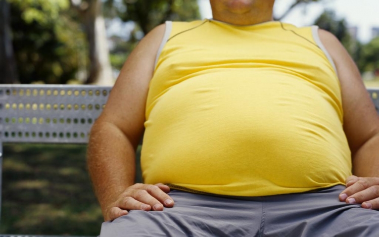Az elhízottak többsége nem marad tartósan egészséges
